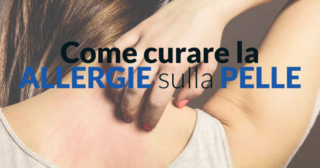 Come curare le allergie sulla pelle - Dermatologo Specialista