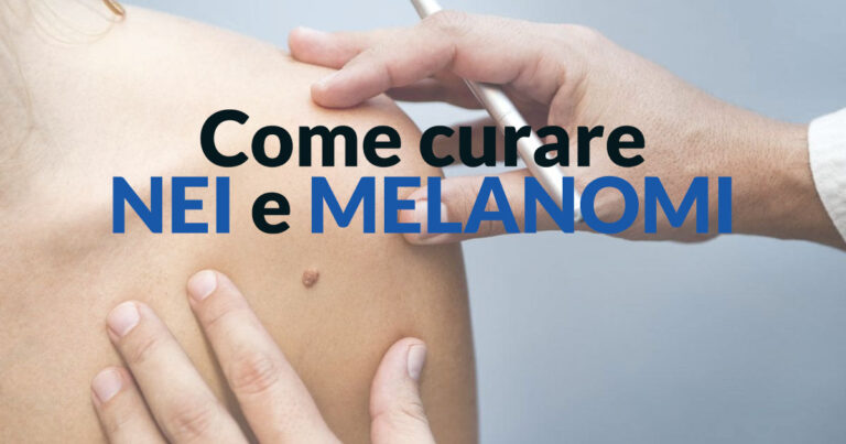 Come curare nei e melanomi - Stefano Veglio